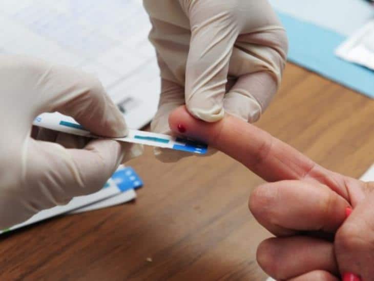Realizarán en Xalapa pruebas gratuitas de detección del VIH