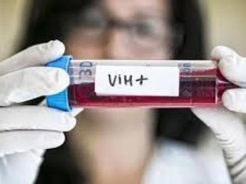 Veracruz, tercer lugar nacional en casos de VIH