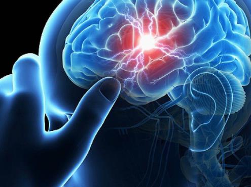 Atención oportuna de infartos cerebrales salva vidas, advierte IMSS