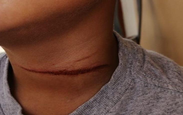 Niño corta el cuello a su compañero en escuela de Veracruz 