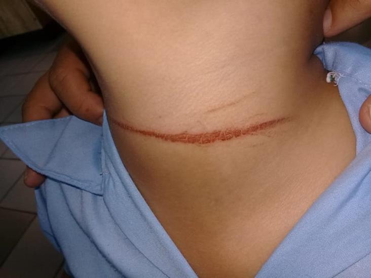 Niño corta el cuello a su compañero en escuela de Veracruz 