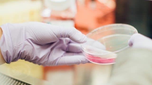 Confirman segundo caso en el mundo de curación de VIH con células madre