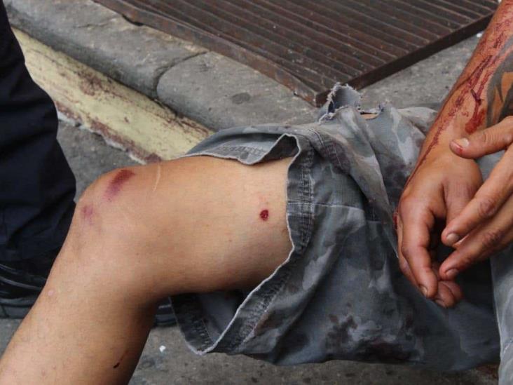 Hallan a sujeto baleado en calles de Xalapa