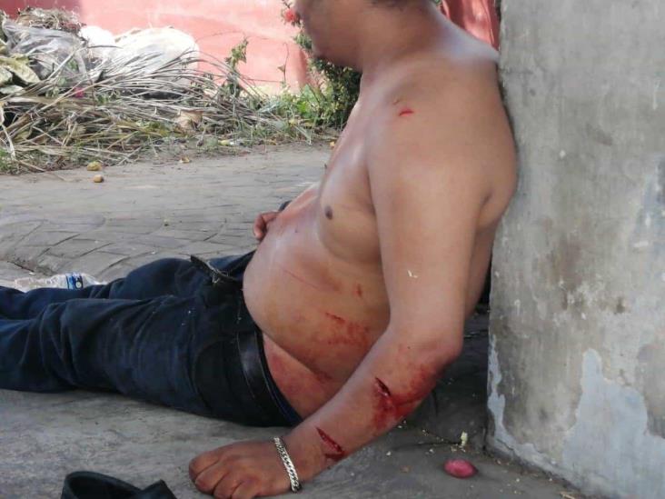 Asaltan y lesionan a dos hombres en Veracruz