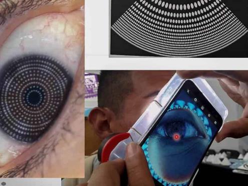 Desarrollan en la UNAM topógrafo corneal que detecta problemas visuales