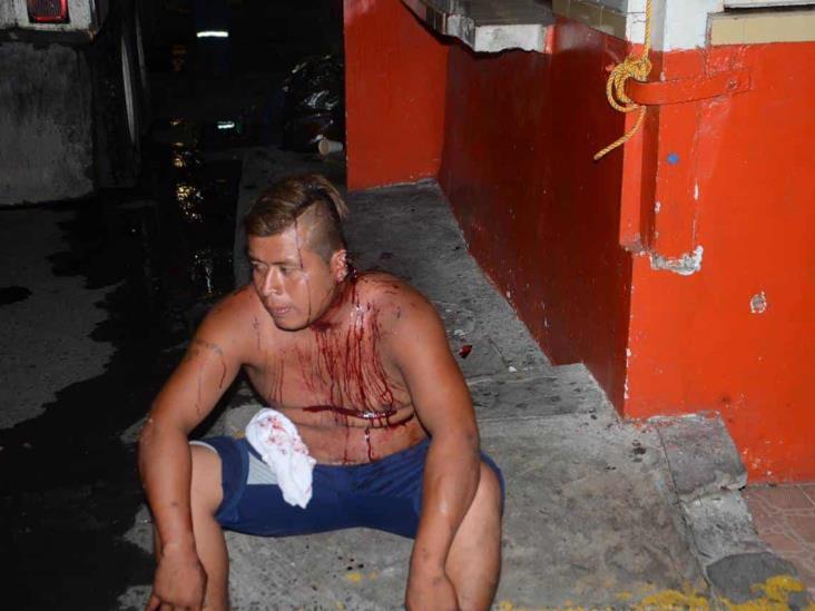 Riña entre dos sujetos termina con una persona herida en Veracruz