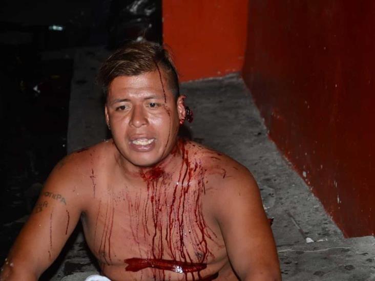 Riña entre dos sujetos termina con una persona herida en Veracruz