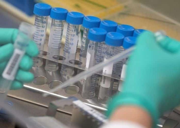 Conago invita a gobernadores a reunir recursos para comprar vacunas anti-covid