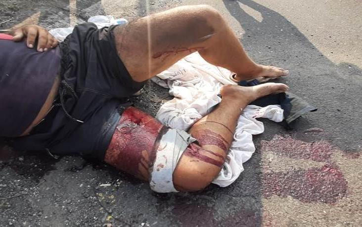 Joven motociclista derrapa en calles del Nuevo Veracruz