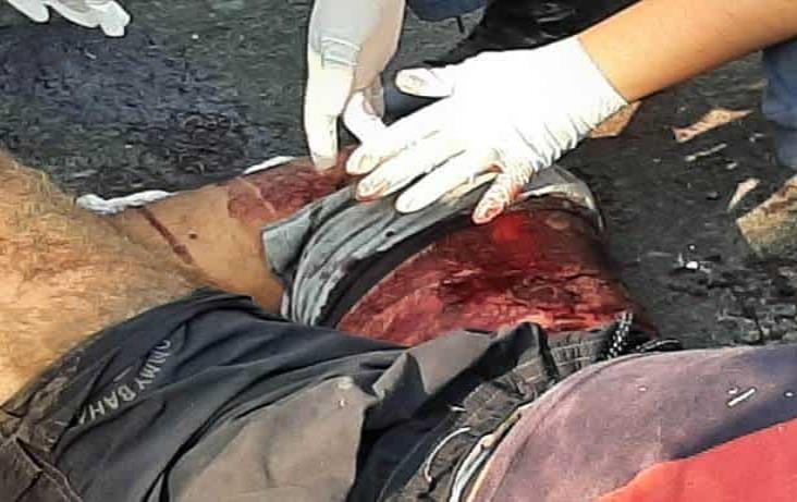 Joven motociclista derrapa en calles del Nuevo Veracruz