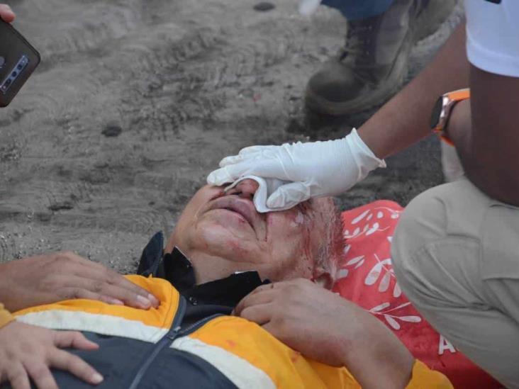 Anciano se golpea la cabeza tras resbalarse en puente de Boca del Río