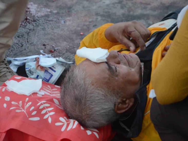 Anciano se golpea la cabeza tras resbalarse en puente de Boca del Río