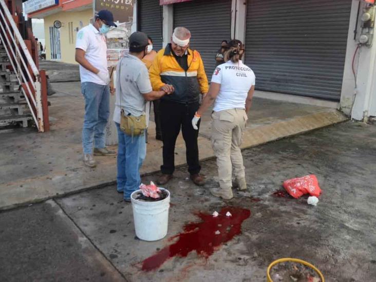 Anciano se golpea la cabeza tras resbalarse en puente de Boca del Río