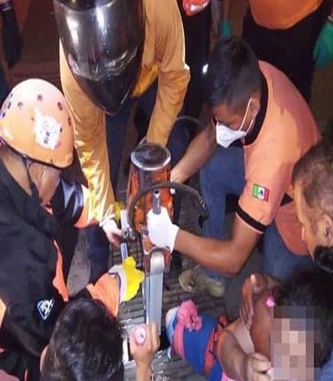 Mujer se atora en rejilla de alcantarilla y sufre gran herida, en Xalapa