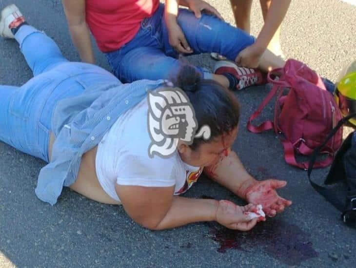 Madre e hija heridas tras choque sobre la Acayucan – Jáltipan de Morelos 