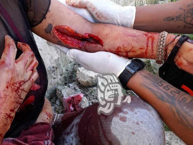 De varias puñaladas, mujer es herida por ex pareja en colonia Las Torres, en Xalapa