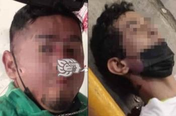 Asaltante baleado en Minatitlán, con largo historial en el Cereso


