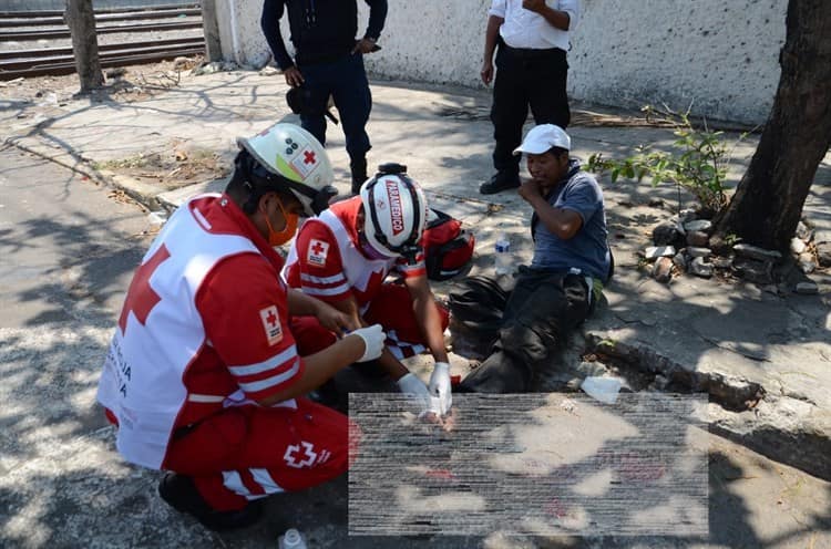 Jornalero se accidenta en colonia de Veracruz, locomotora le amputa el pie