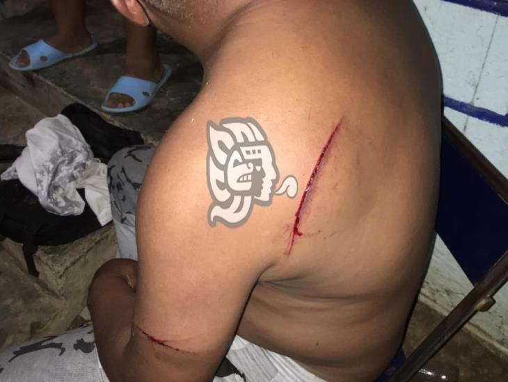 A ‘planazos’ con machete fue herido comerciante en Acayucan