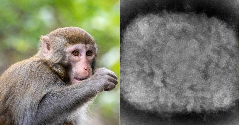 ¿Cuáles son los síntomas de la viruela del mono y cómo prevenirla?