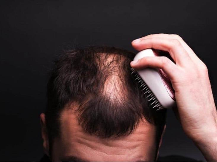 Aprueba EU píldora contra la alopecia