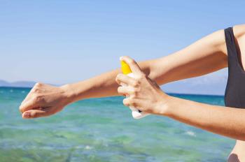 ¿No sabes si eres alérgico al sol? ¡Cuidado! Estos son síntomas que te deben alertar