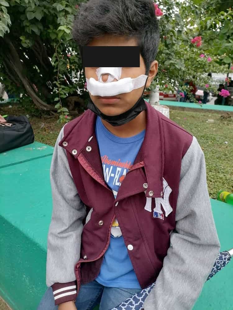 Menor es golpeado por un compañero de secundaria en Poza Rica
