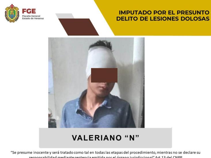 Lo imputan por presuntas lesiones dolosas en Chicontepec