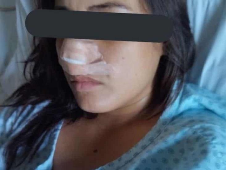 Realizan primera cirugía de reconstrucción de nariz a joven agredida por excandidato