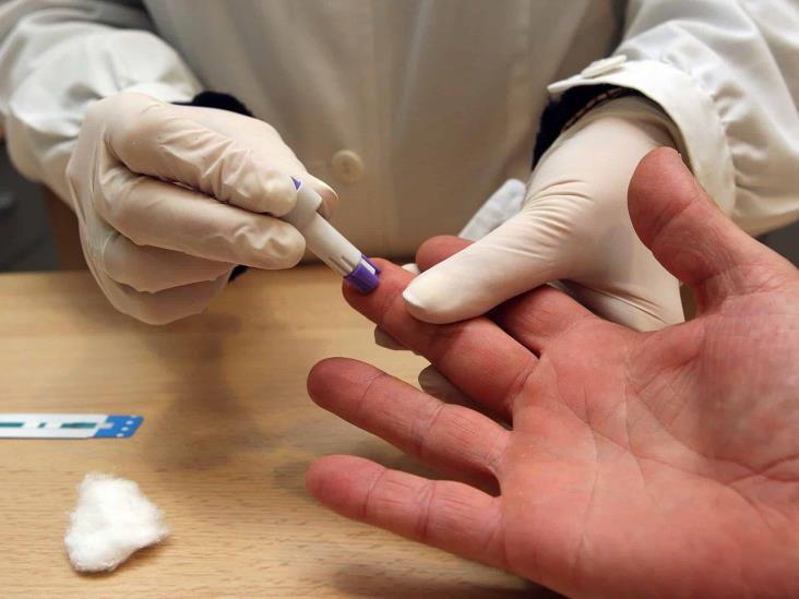 Detectan primer caso de hombre contagiado de VIH, viruela del mono y covid-19