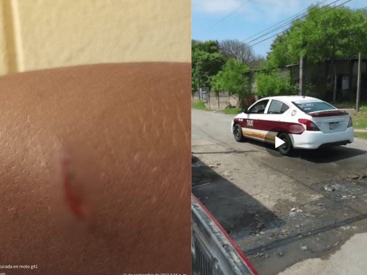 Denuncian a taxista en Veracruz por presuntamente lesionar a pasajero en el tránsito