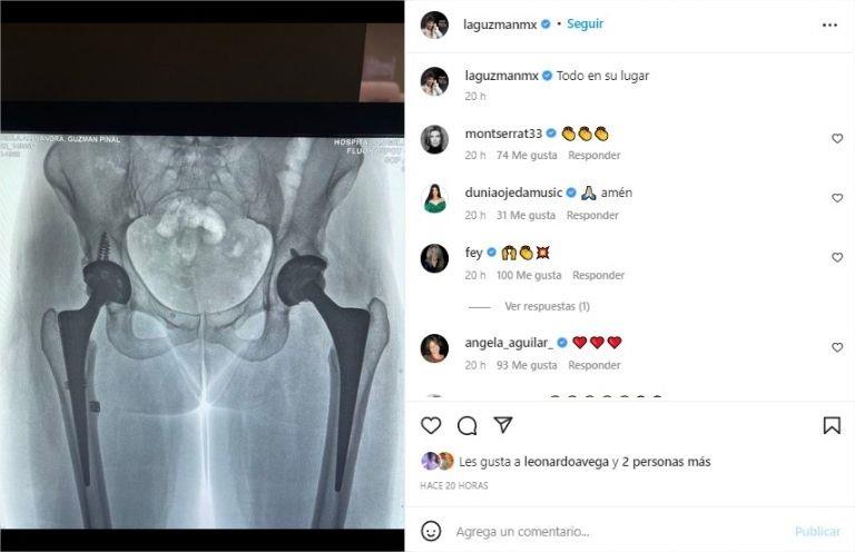 Alejandra Guzmán muestra como quedó su cadera luego de grave caída en concierto