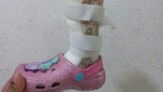 Menor pierde prótesis en calles de Veracruz; piden el apoyo para localizarla