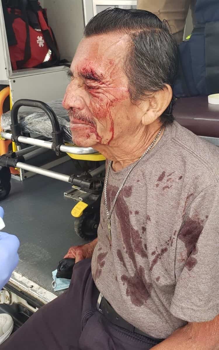 Sexagenario herido de la cabeza tras desmayo en Cosamaloapan