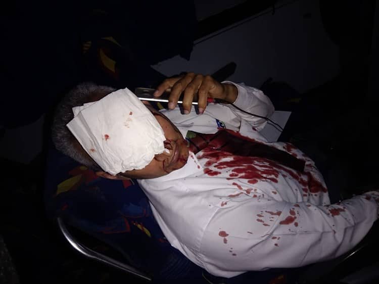 Camión choca a TRV en Cosamaloapan; atienden pasajeros heridos