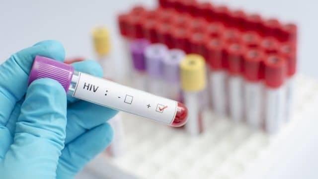 Células madre consiguen posible cura de VIH a mujer