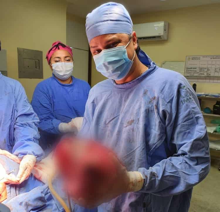 Extirpan especialistas de UMAE No. 14 del IMSS Veracruz Norte tumor maligno de 13 kilos