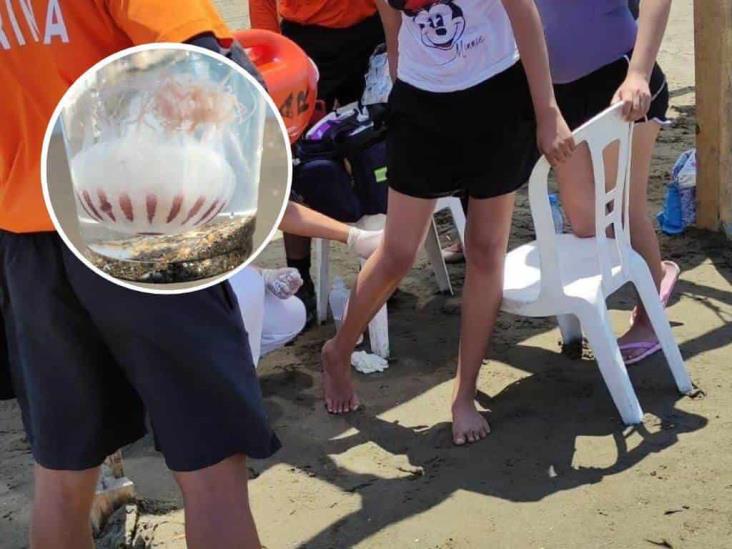 Contacto con medusas manda al hospital a 10 bañistas en playa de Coatzacoalcos