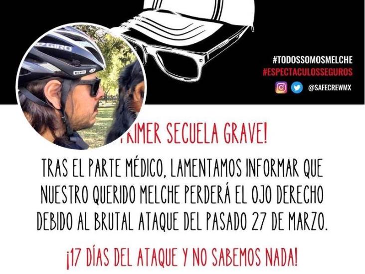Perdería el ojo; mánager de Ximena Sariñana, grave tras ataque en Texcoco