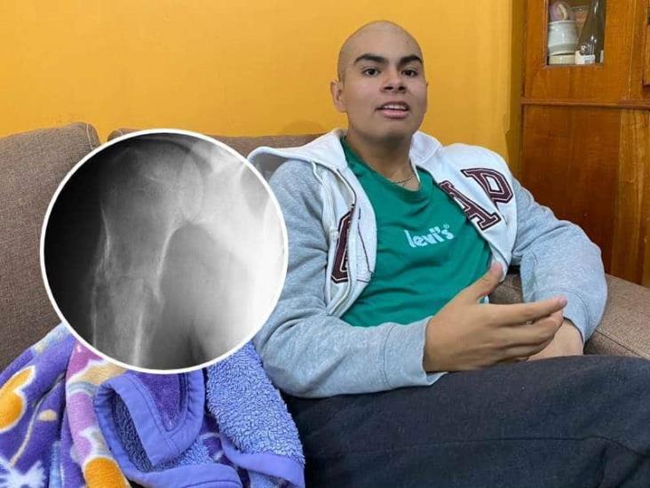 Busca el milagro; Así es la lucha de Bryan contra el cáncer en Xalapa