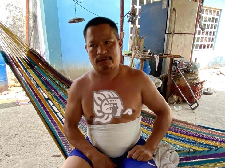 Le quitan 350 pesos y una bolsa de verduras a hombre en Minatitlán; ladrones lo dejaron imposibilitado