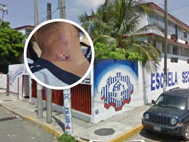 Detectan más casos de bullying dentro de la ETI 1 en Veracruz