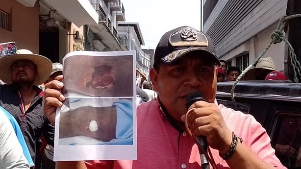 Cierran calles por presunta negligencia en hospital de Orizaba