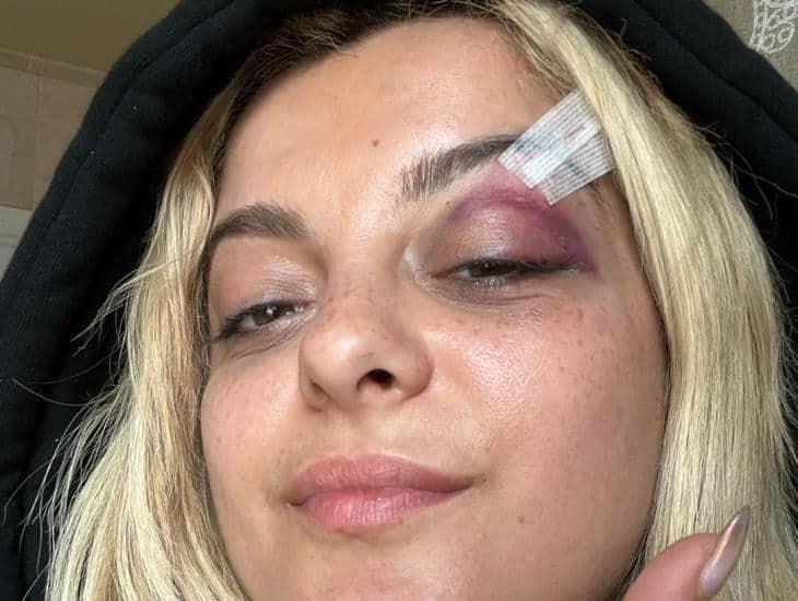 “Estoy bien”: Bebe Rexha responde tras golpe con celular en Nueva York