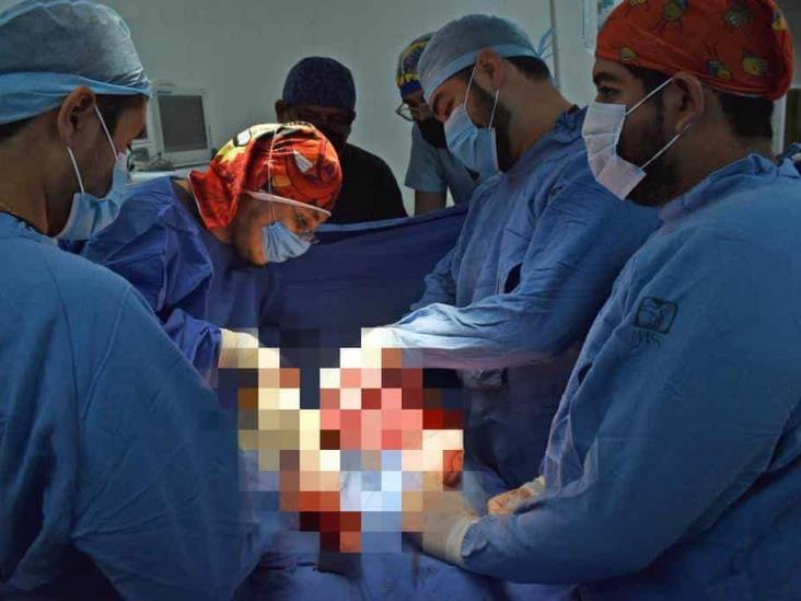 Extirpan tumor de 4 kilogramos en hospital IMSS-Bienestar de Chicontepec