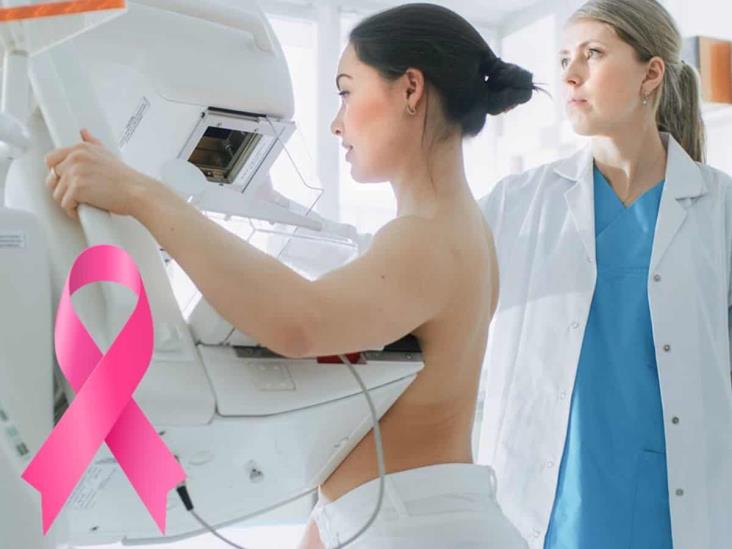 Día Mundial contra el Cáncer de Mama: ¿a qué edad debe realizarse la mastografía?