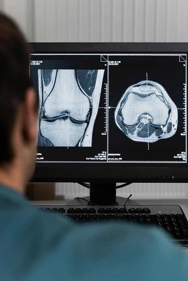 Destaca IMSS Veracruz Norte importancia de Radiología