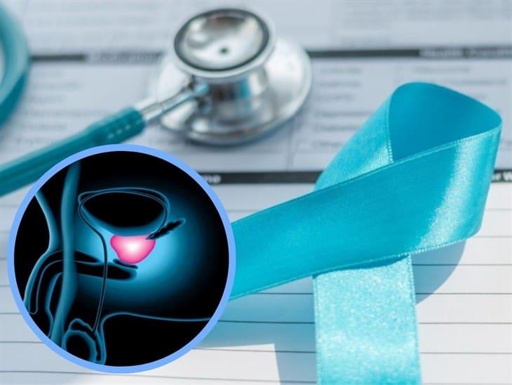 IMSS Veracruz Norte recomienda revisión para prevenir el cáncer de próstata