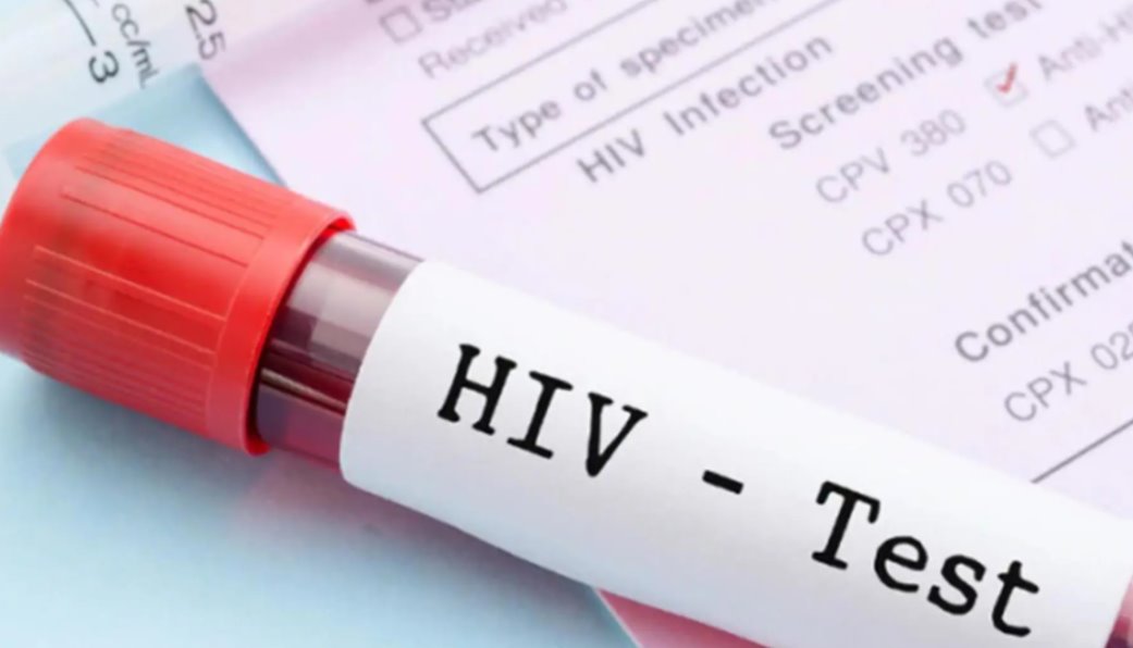 Con tratamiento oportuno pacientes con VIH pueden vivir como alguien sin infección