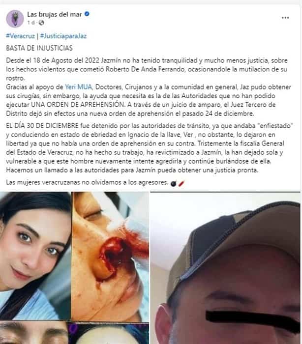 Amparan a Roberto “N”, acusado de lesionar en la nariz a Jazmín en Tlalixcoyan, Veracruz